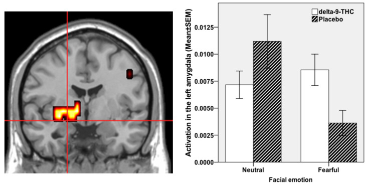 PMC8471665 – brainsci-11-01240-f001