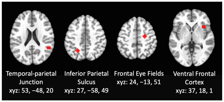 PMC8870263 – brainsci-12-00287-f001