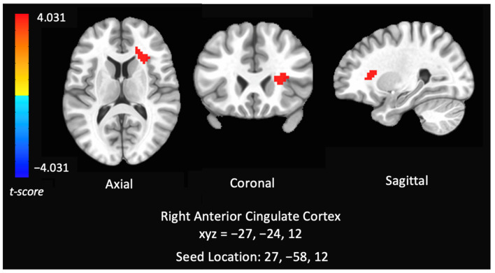 PMC8870263 – brainsci-12-00287-f002