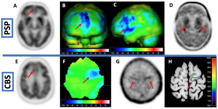 PMC9496752 – brainsci-12-01146-f004