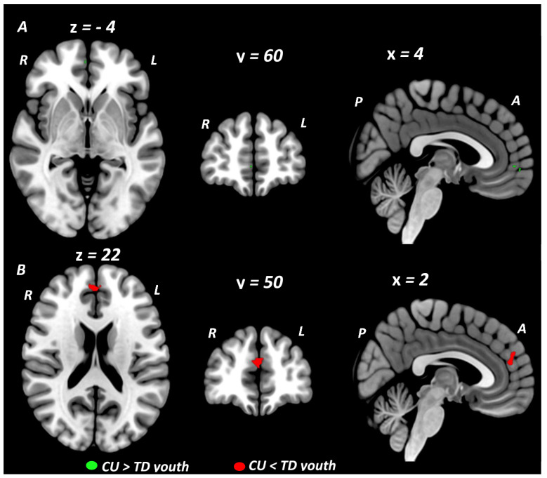 PMC9599849 – brainsci-12-01281-f002