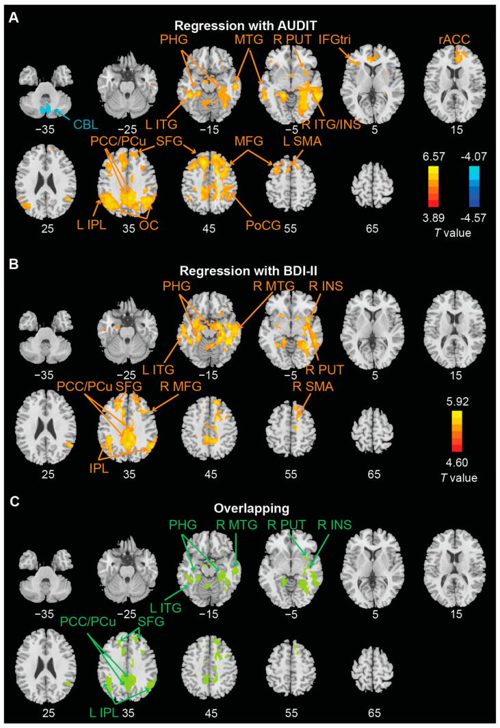 PMC9775947 – brainsci-12-01689-f003