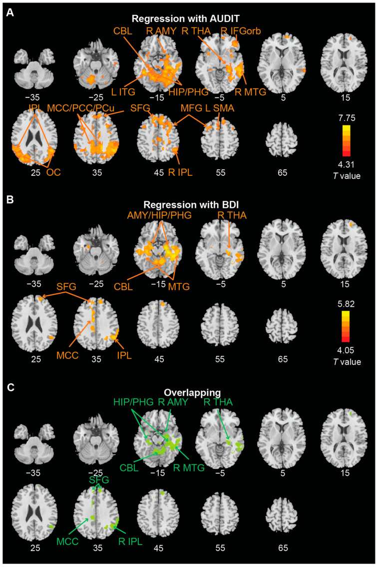 PMC9775947 – brainsci-12-01689-f004