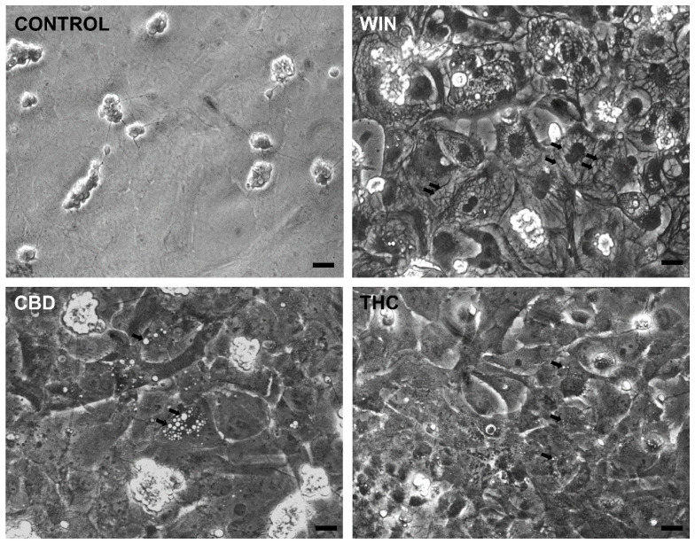 PMC11940308 – brainsci-15-00291-f003