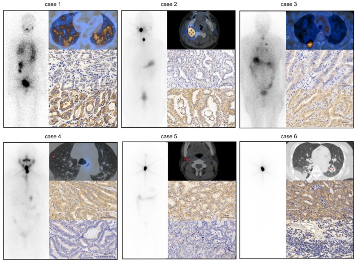 PMC8909796 – cancers-14-01268-f002