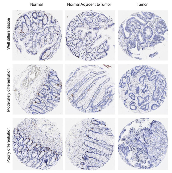 PMC9179857 – cancers-14-02664-f005
