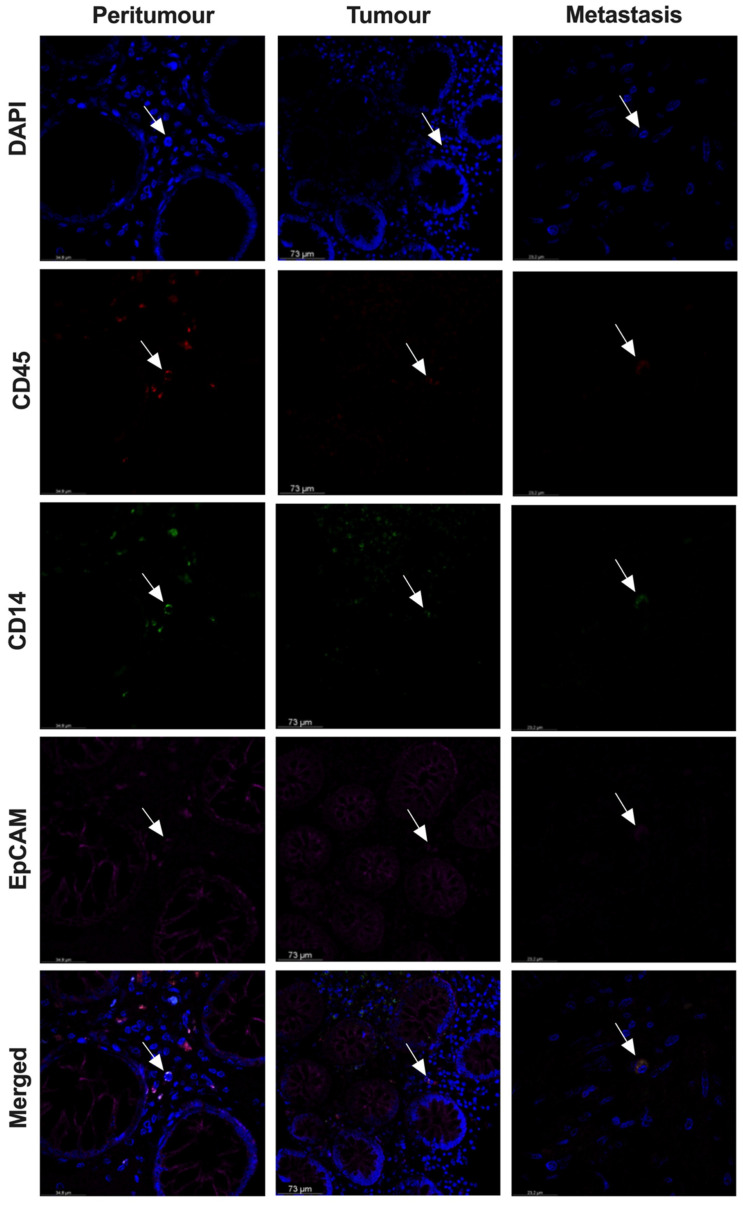 PMC9324286 – cancers-14-03445-f007