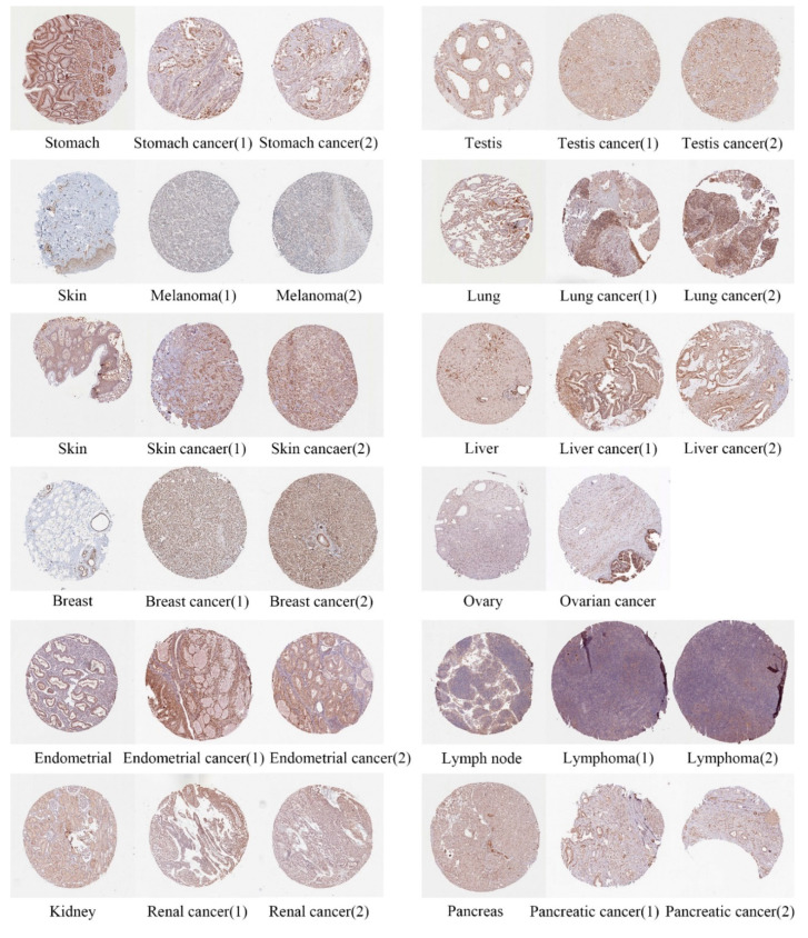 PMC9558978 – cancers-14-04595-f002