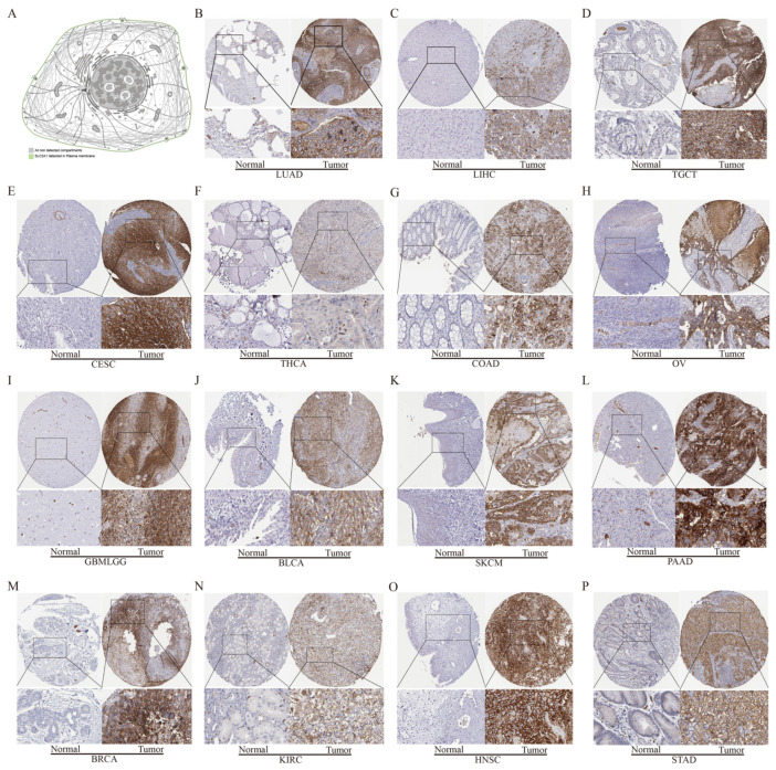 PMC9657346 – cancers-14-05344-f004