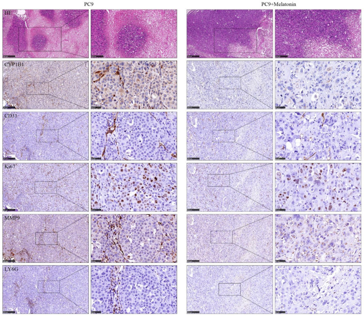 PMC9688555 – cancers-14-05641-f006
