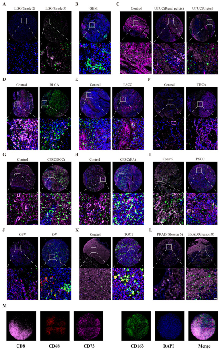 PMC9688912 – cancers-14-05663-f007