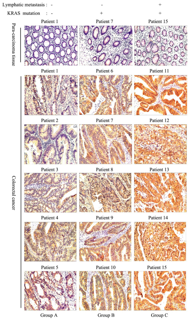 PMC9688869 – cancers-14-05704-f003