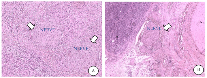 PMC9739544 – cancers-14-05793-f001