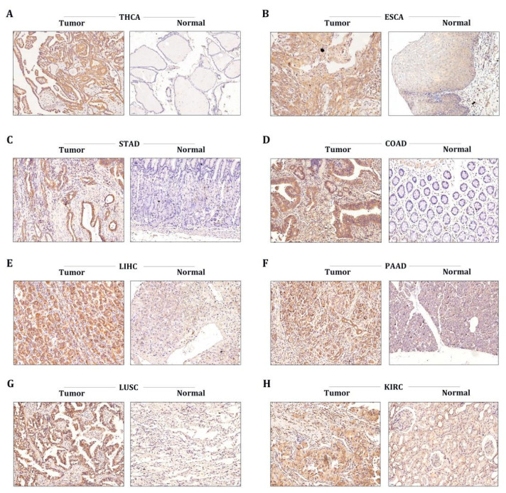 PMC9817965 – cancers-15-00027-f006