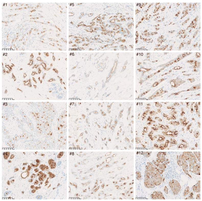 PMC10046670 – cancers-15-01830-f003