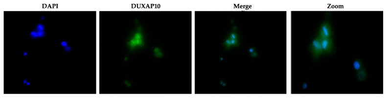 PMC12691012 – cancers-17-03852-f005