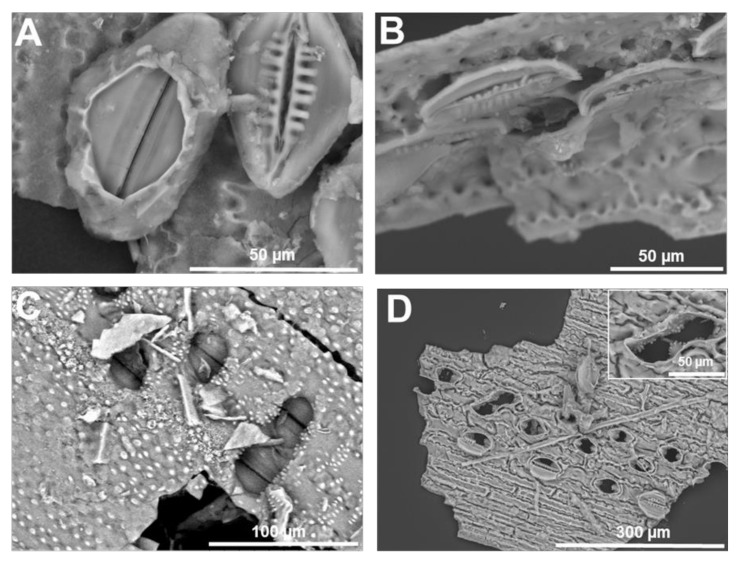 PMC7225990 – cells-09-01066-f004