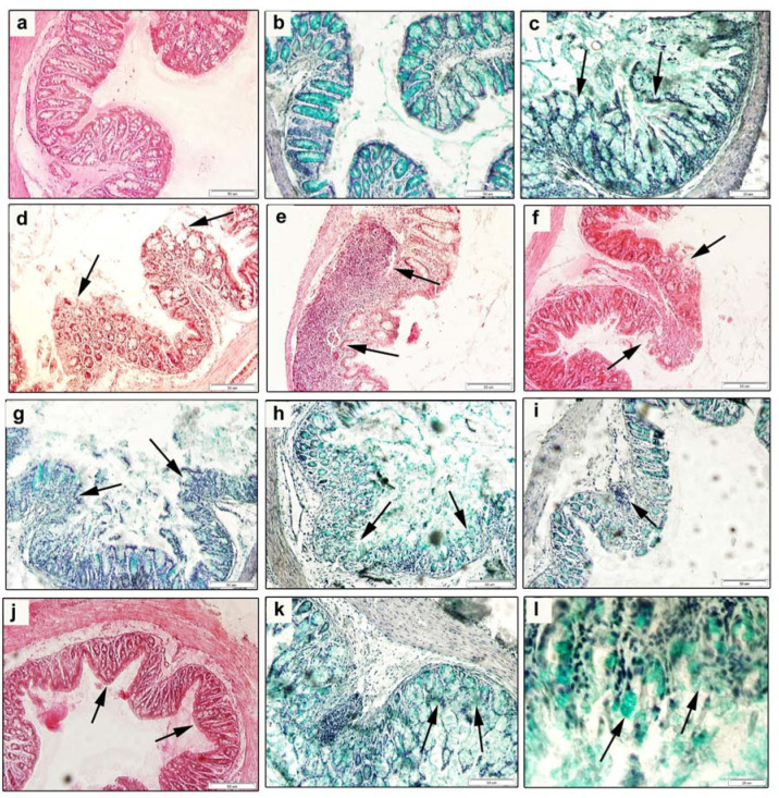 PMC7761014 – cells-09-02571-f004