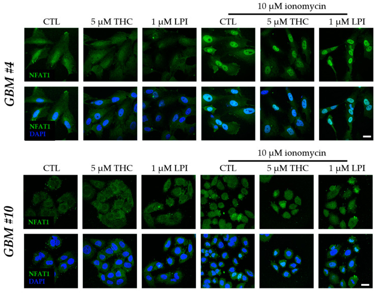 PMC10670585 – cells-12-02646-f010