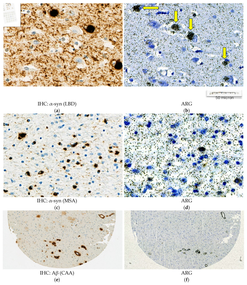 PMC12190736 – cells-14-00869-f004