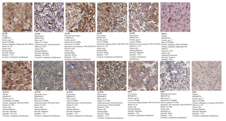 PMC11430384 – cimb-46-00600-f011