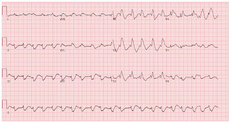 PMC5965161 – f1-cpcem-01-166