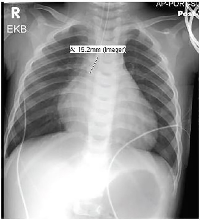 PMC5965161 – f2-cpcem-01-166