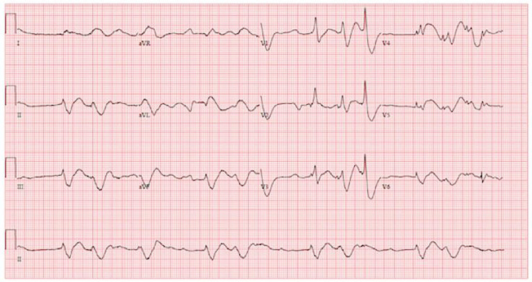 PMC5965161 – f3-cpcem-01-166