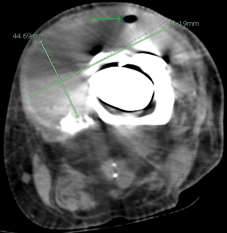 PMC10065365 – FIG1