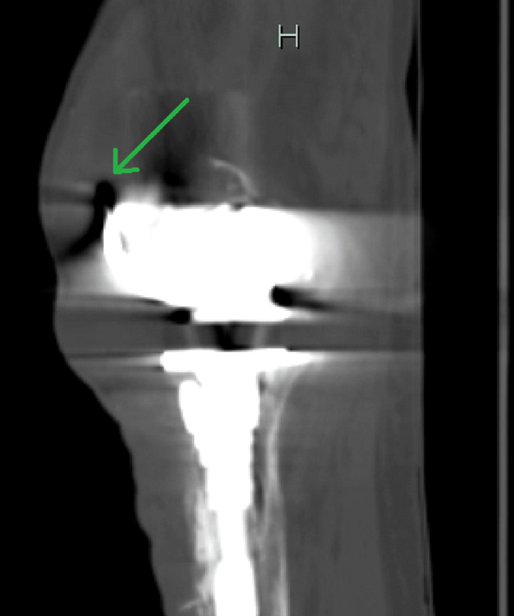 PMC10065365 – FIG2