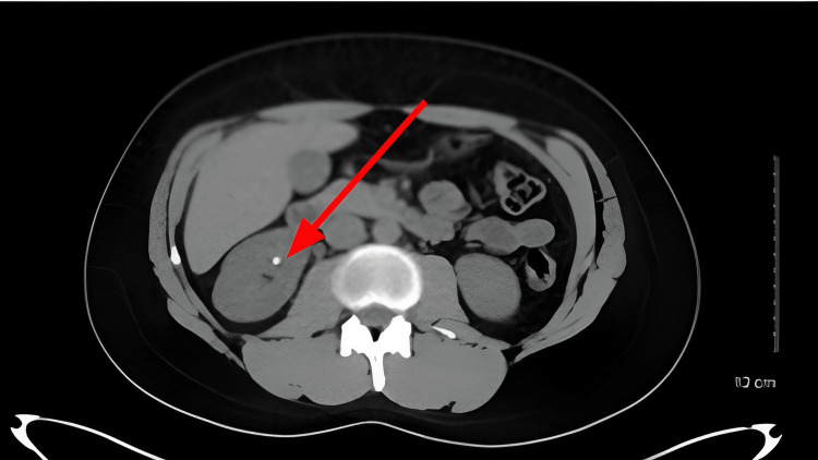 PMC10163339 – FIG1
