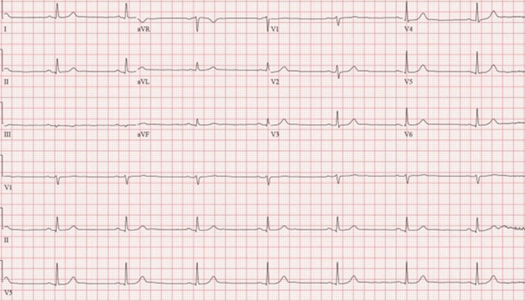 PMC10174675 – FIG1