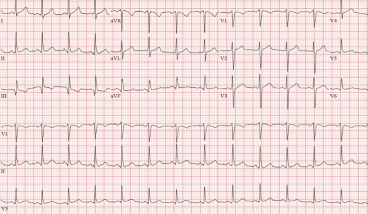 PMC10174675 – FIG2