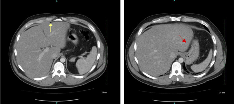 PMC10181893 – FIG1
