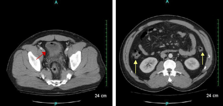 PMC10181893 – FIG2