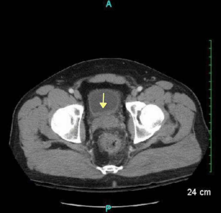 PMC10181893 – FIG3