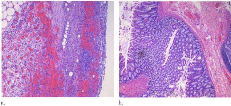 PMC10181893 – FIG4
