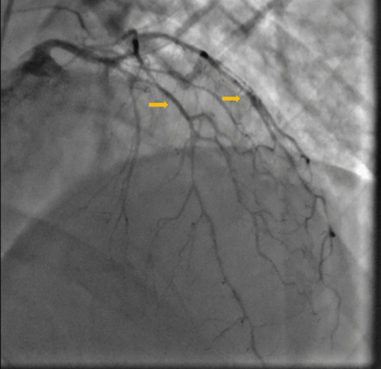 PMC10205149 – FIG1