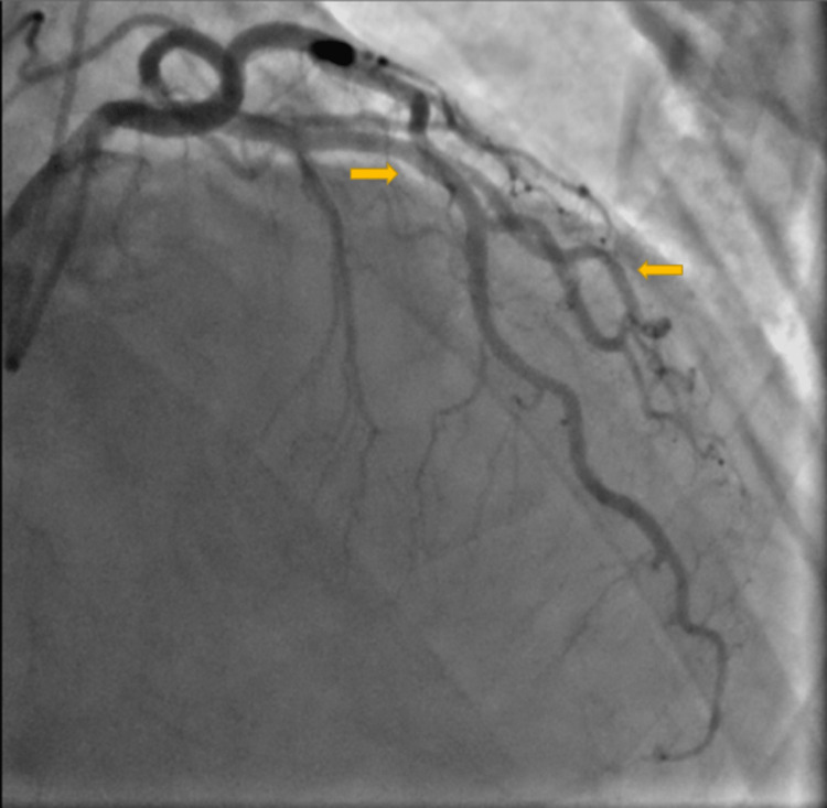 PMC10205149 – FIG2
