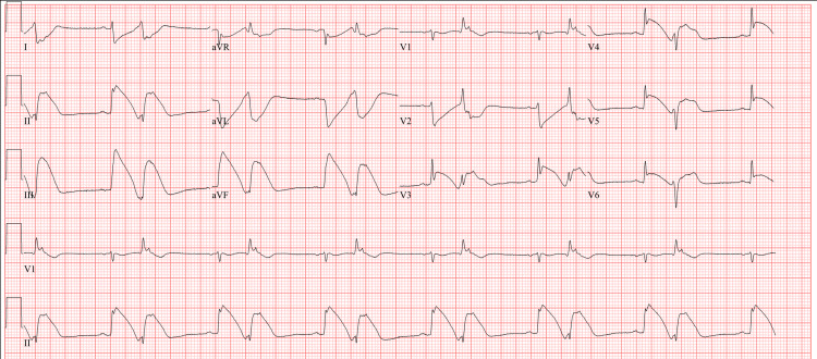 PMC10205149 – FIG3