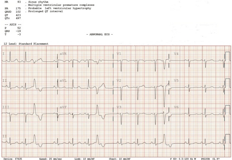 PMC10211399 – FIG1