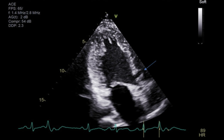 PMC10211399 – FIG2