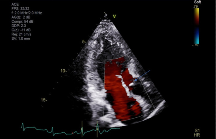 PMC10211399 – FIG3