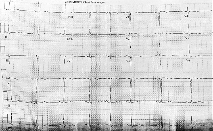 PMC10211399 – FIG4