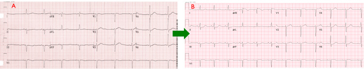 PMC10234142 – FIG1