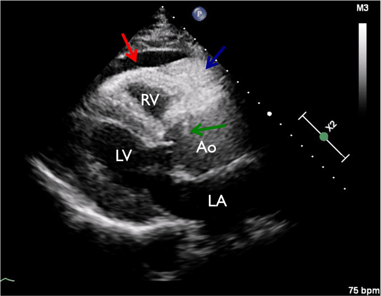 PMC10234142 – FIG2