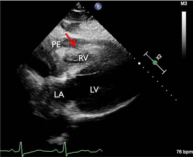 PMC10234142 – FIG3