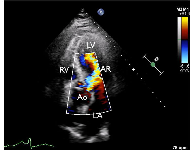 PMC10234142 – FIG4