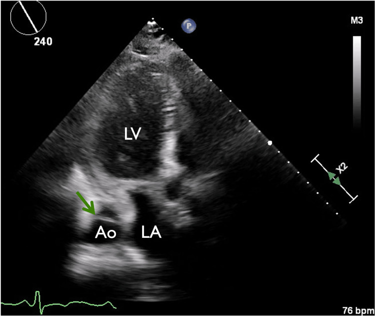 PMC10234142 – FIG5
