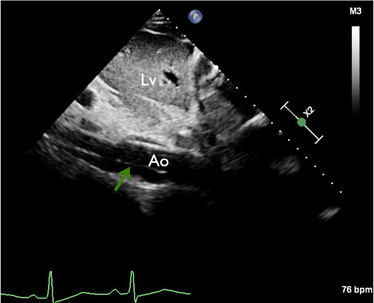 PMC10234142 – FIG6